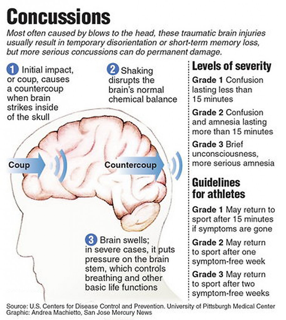 CIFCIN Cover Concussion Diagram2